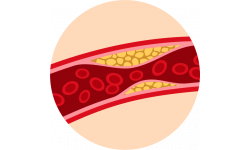 Cholesterol